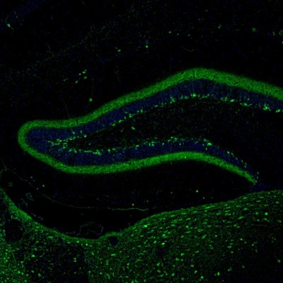 Immunohistochemistry (Formalin/PFA-fixed paraffin-embedded sections) - Anti-Calretinin antibody (AB244299), expandable thumbnail