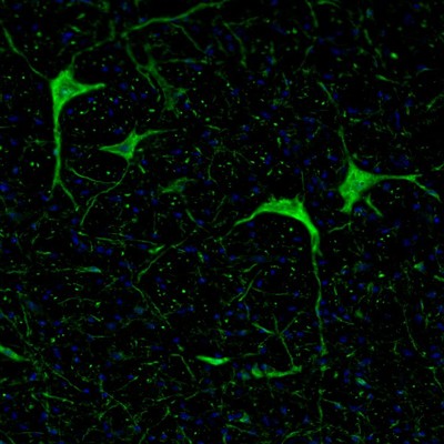 Immunohistochemistry (Formalin/PFA-fixed paraffin-embedded sections) - Anti-Calretinin antibody (ab244299), expandable thumbnail