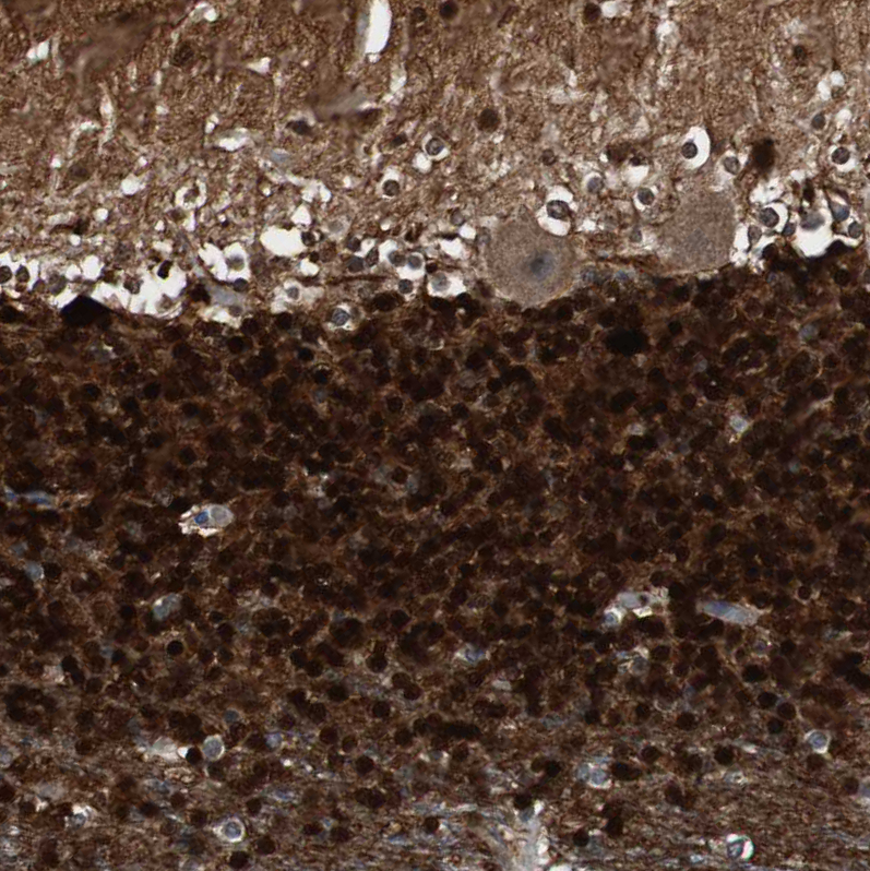 Immunohistochemistry (Formalin/PFA-fixed paraffin-embedded sections) - Anti-Calretinin antibody (AB244299), expandable thumbnail
