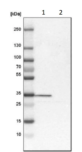 Western blot - Anti-Calretinin antibody (AB244299)