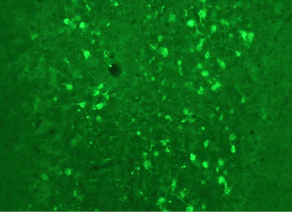 Immunohistochemistry (Frozen sections) - Anti-Calretinin antibody (AB254070)