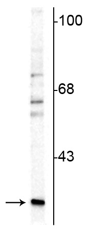 Western blot - Anti-Calretinin antibody (AB254070), expandable thumbnail