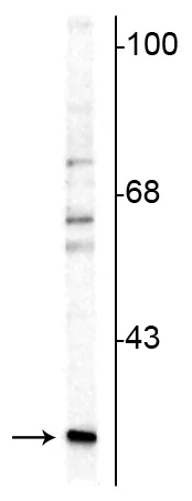 Western blot - Anti-Calretinin antibody (AB254070)