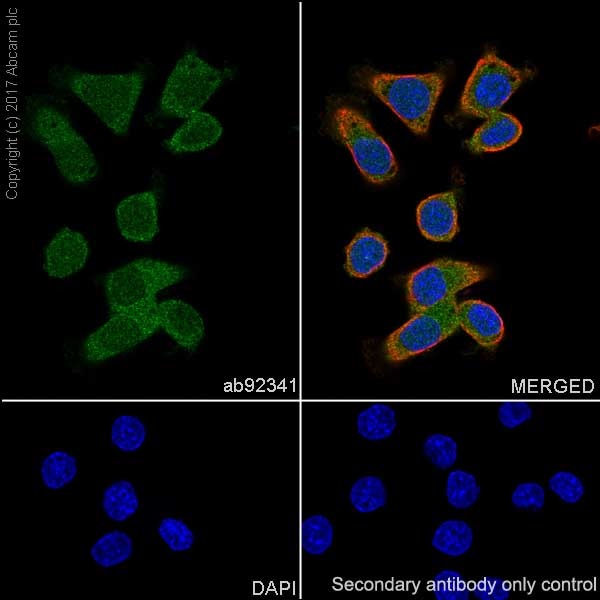 Immunocytochemistry/ Immunofluorescence - Anti-Calretinin antibody [EP1798] (AB92341), expandable thumbnail