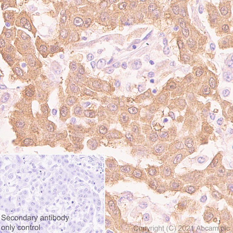 Immunohistochemistry (Formalin/PFA-fixed paraffin-embedded sections) - Anti-Calretinin antibody [EP1798] (AB92341)