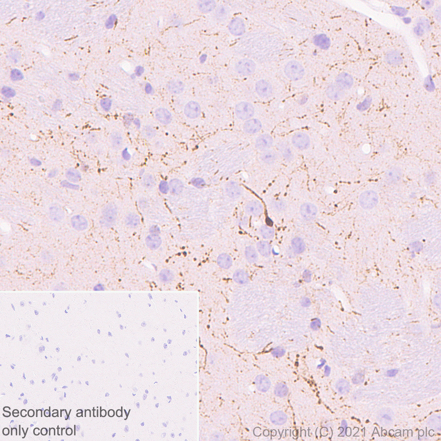Immunohistochemistry (Formalin/PFA-fixed paraffin-embedded sections) - Anti-Calretinin antibody [EP1798] (AB92341), expandable thumbnail