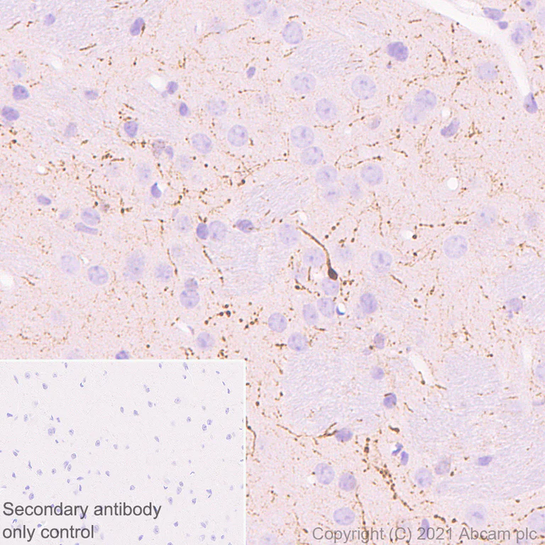 Immunohistochemistry (Formalin/PFA-fixed paraffin-embedded sections) - Anti-Calretinin antibody [EP1798] (AB92341)