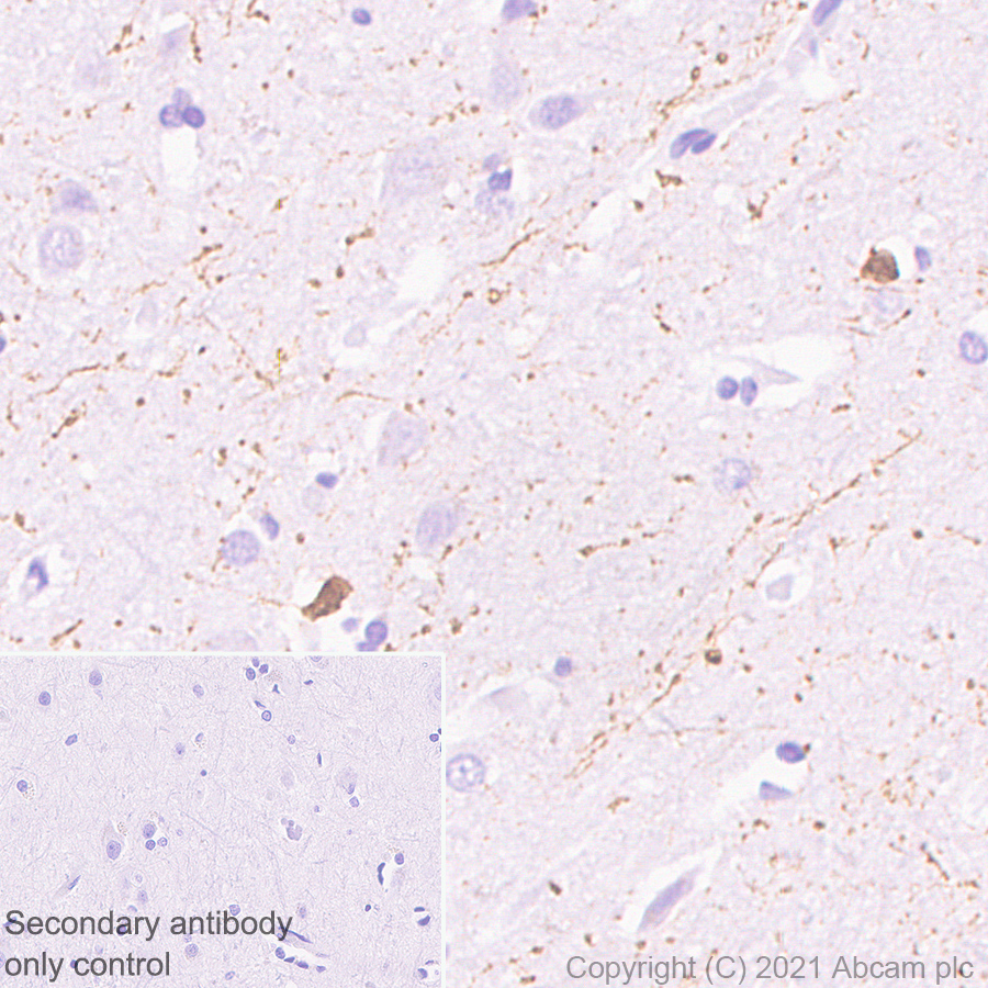 Immunohistochemistry (Formalin/PFA-fixed paraffin-embedded sections) - Anti-Calretinin antibody [EP1798] (ab92341), expandable thumbnail
