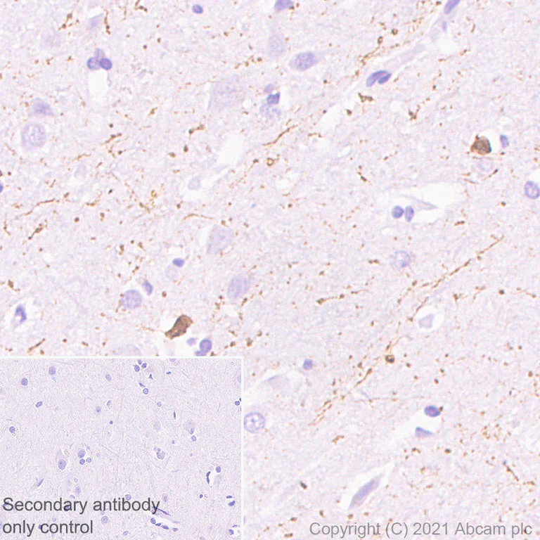 Immunohistochemistry (Formalin/PFA-fixed paraffin-embedded sections) - Anti-Calretinin antibody [EP1798] (AB92341)