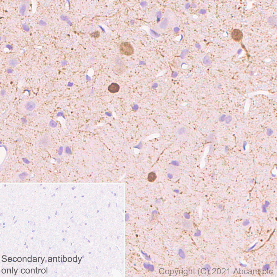 Immunohistochemistry (Formalin/PFA-fixed paraffin-embedded sections) - Anti-Calretinin antibody [EP1798] (AB92341), expandable thumbnail
