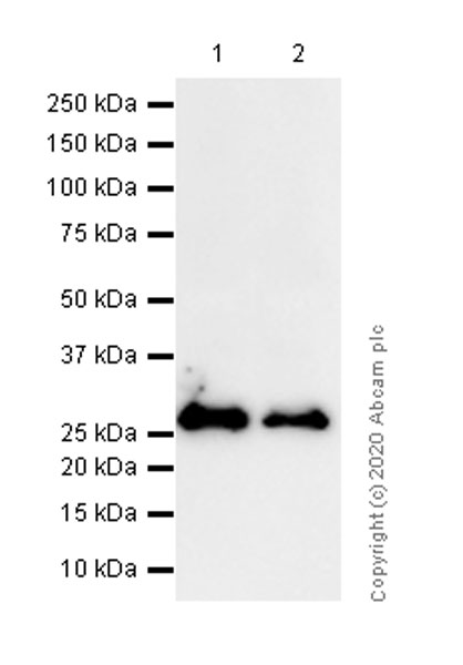 Western blot - Anti-Calretinin antibody [EP1798] (AB92341), expandable thumbnail