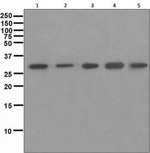 Western blot - Anti-Calretinin antibody [EPR1799(2)] (AB133316)