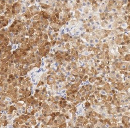 Immunohistochemistry (Formalin/PFA-fixed paraffin-embedded sections) - Anti-Calretinin antibody [SP13] (AB16694)