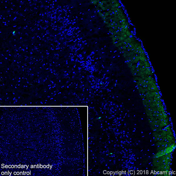 Immunohistochemistry (Frozen sections) - Anti-Calretinin antibody [SP13] (AB16694)
