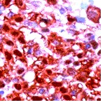 Immunohistochemistry (Formalin/PFA-fixed paraffin-embedded sections) - Anti-Calretinin antibody [SP13] - BSA and Azide free (AB239795)