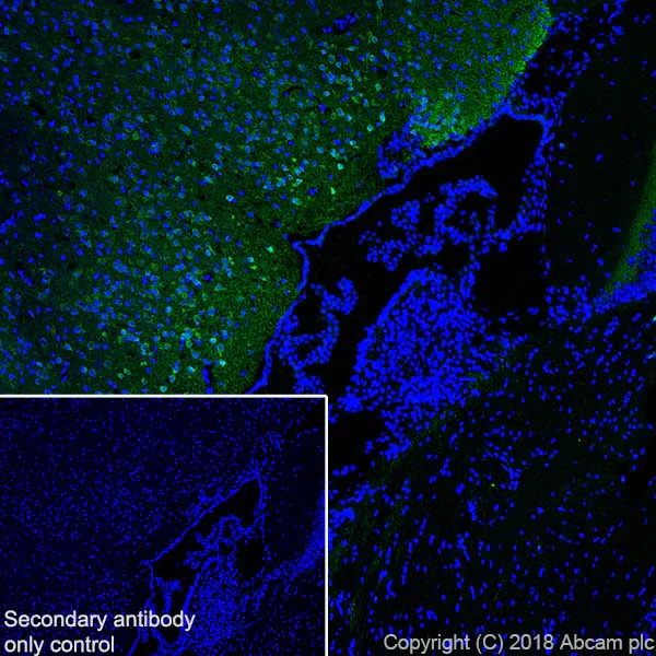 Immunohistochemistry (Frozen sections) - Anti-Calretinin antibody [SP13] - BSA and Azide free (AB239795)