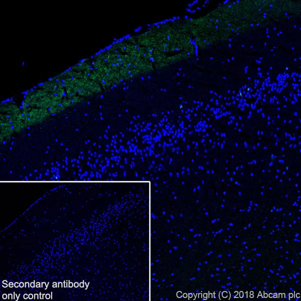 Immunohistochemistry (Frozen sections) - Anti-Calretinin antibody [SP13] - BSA and Azide free (AB239795)