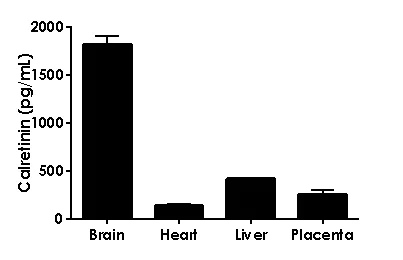 Sandwich ELISA - Calretinin ELISA Kit (AB233616)