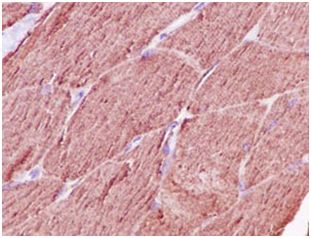Immunohistochemistry (Formalin/PFA-fixed paraffin-embedded sections) - Anti-Calsequestrin 1 antibody [EPR15226(B)] (AB185220), expandable thumbnail