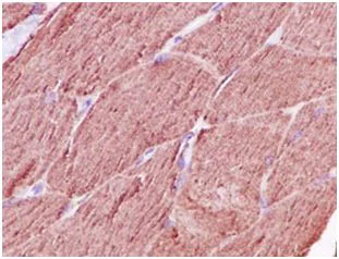 Immunohistochemistry (Formalin/PFA-fixed paraffin-embedded sections) - Anti-Calsequestrin 1 antibody [EPR15226(B)] (AB185220)