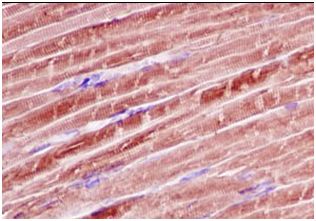 Immunohistochemistry (Formalin/PFA-fixed paraffin-embedded sections) - Anti-Calsequestrin 1 antibody [EPR15226(B)] (AB185220), expandable thumbnail