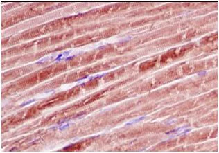 Immunohistochemistry (Formalin/PFA-fixed paraffin-embedded sections) - Anti-Calsequestrin 1 antibody [EPR15226(B)] (AB185220)