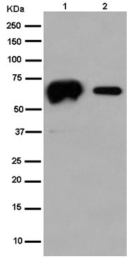 Western blot - Anti-Calsequestrin 1 antibody [EPR15226(B)] (AB185220), expandable thumbnail