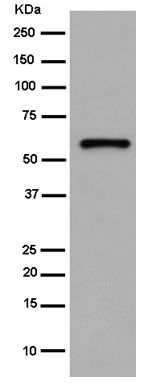 Western blot - Anti-Calsequestrin 1 antibody [EPR15226(B)] (AB185220), expandable thumbnail