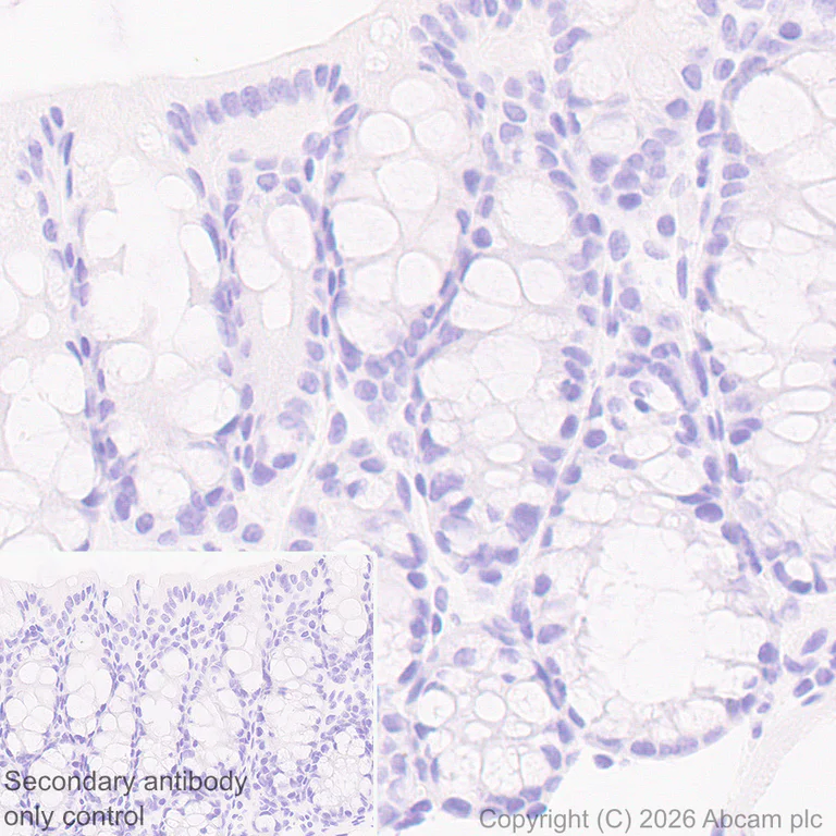 Immunohistochemistry (Formalin/PFA-fixed paraffin-embedded sections) - Anti-Calsequestrin 1 antibody [EPR15227(B)] (AB191564)