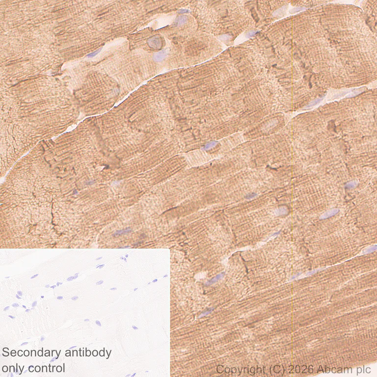 Immunohistochemistry (Formalin/PFA-fixed paraffin-embedded sections) - Anti-Calsequestrin 1 antibody [EPR15227(B)] (AB191564)