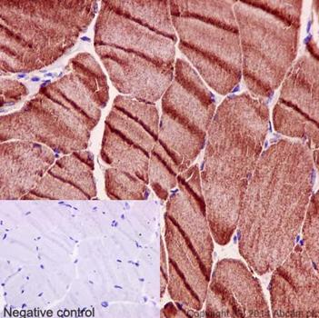 Immunohistochemistry (Formalin/PFA-fixed paraffin-embedded sections) - Anti-Calsequestrin 1 antibody [EPR15227(B)] (AB191564)