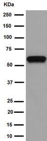 Western blot - Anti-Calsequestrin 1 antibody [EPR15227(B)] (AB191564)