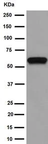 Western blot - Anti-Calsequestrin 1 antibody [EPR15227(B)] - BSA and Azide free (AB251086)