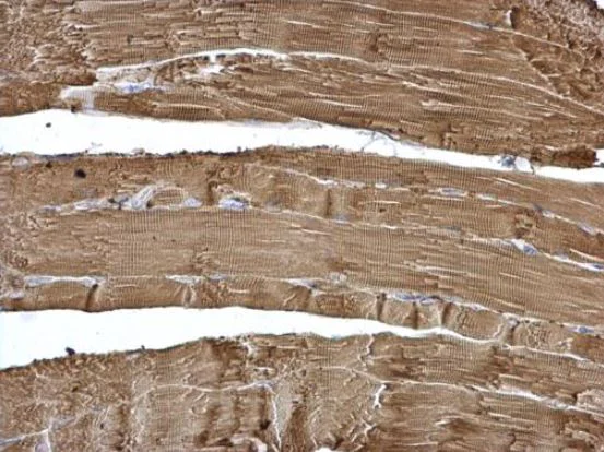 Immunohistochemistry (Formalin/PFA-fixed paraffin-embedded sections) - Anti-Calsequestrin 2 antibody (AB96387)