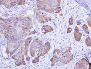 Immunohistochemistry (Formalin/PFA-fixed paraffin-embedded sections) - Anti-Calsequestrin 2 antibody (AB96387)