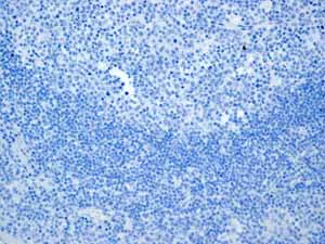 Immunohistochemistry (Formalin/PFA-fixed paraffin-embedded sections) - Anti-Calsequestrin 2 antibody [EPR4228] (AB108381)
