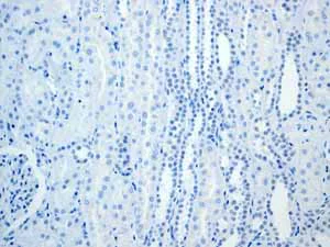Immunohistochemistry (Formalin/PFA-fixed paraffin-embedded sections) - Anti-Calsequestrin 2 antibody [EPR4228] (AB108381)