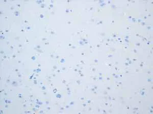 Immunohistochemistry (Formalin/PFA-fixed paraffin-embedded sections) - Anti-Calsequestrin 2 antibody [EPR4228] (AB108381)