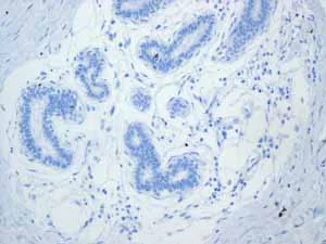 Immunohistochemistry (Formalin/PFA-fixed paraffin-embedded sections) - Anti-Calsequestrin 2 antibody [EPR4228] (AB108381)
