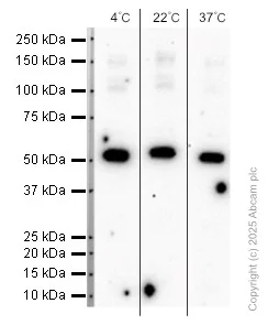 Western blot - Anti-Calsequestrin 2 antibody [EPR4228] (AB108381)