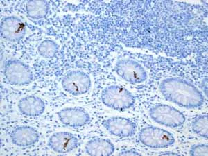 Immunohistochemistry (Formalin/PFA-fixed paraffin-embedded sections) - Anti-Calsequestrin 2 antibody [EPR4228] - BSA and Azide free (AB247652)