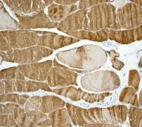 Immunohistochemistry (Formalin/PFA-fixed paraffin-embedded sections) - Anti-Calsequestrin 2 antibody [EPR4228] - BSA and Azide free (AB247652)