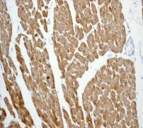 Immunohistochemistry (Formalin/PFA-fixed paraffin-embedded sections) - Anti-Calsequestrin 2 antibody [EPR4228] - BSA and Azide free (AB247652)