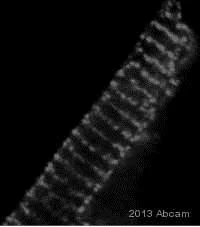 Immunocytochemistry/ Immunofluorescence - Anti-Calsequestrin 2 + Calsequestrin 1 antibody (AB3516)