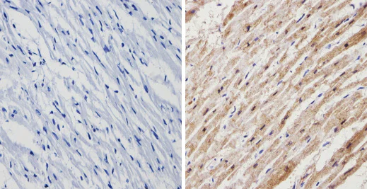 Immunohistochemistry (Formalin/PFA-fixed paraffin-embedded sections) - Anti-Calsequestrin 2 + Calsequestrin 1 antibody (AB3516)