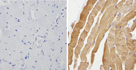 Immunohistochemistry (Formalin/PFA-fixed paraffin-embedded sections) - Anti-Calsequestrin 2 + Calsequestrin 1 antibody (AB3516)