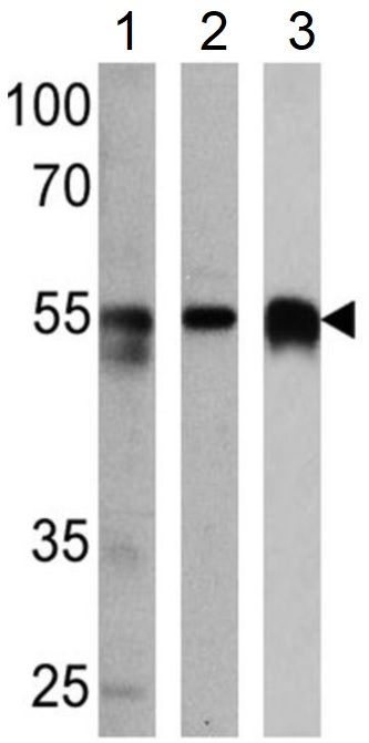 Anti-Calsequestrin 2 + Calsequestrin 1 antibody