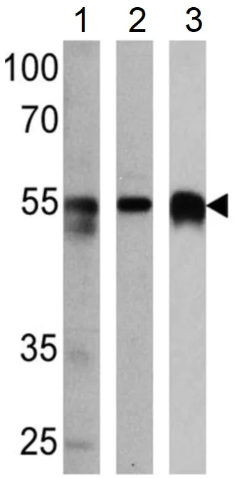 Western blot - Anti-Calsequestrin 2 + Calsequestrin 1 antibody (AB3516)