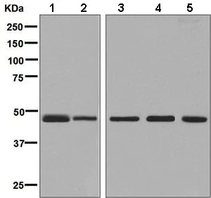 Western blot - Anti-Calumenin antibody [EPR9075] (AB137019)