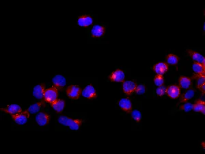 Immunocytochemistry/ Immunofluorescence - Anti-CAMK1D antibody [EPR3536(2)] - BSA and Azide free (AB249712)